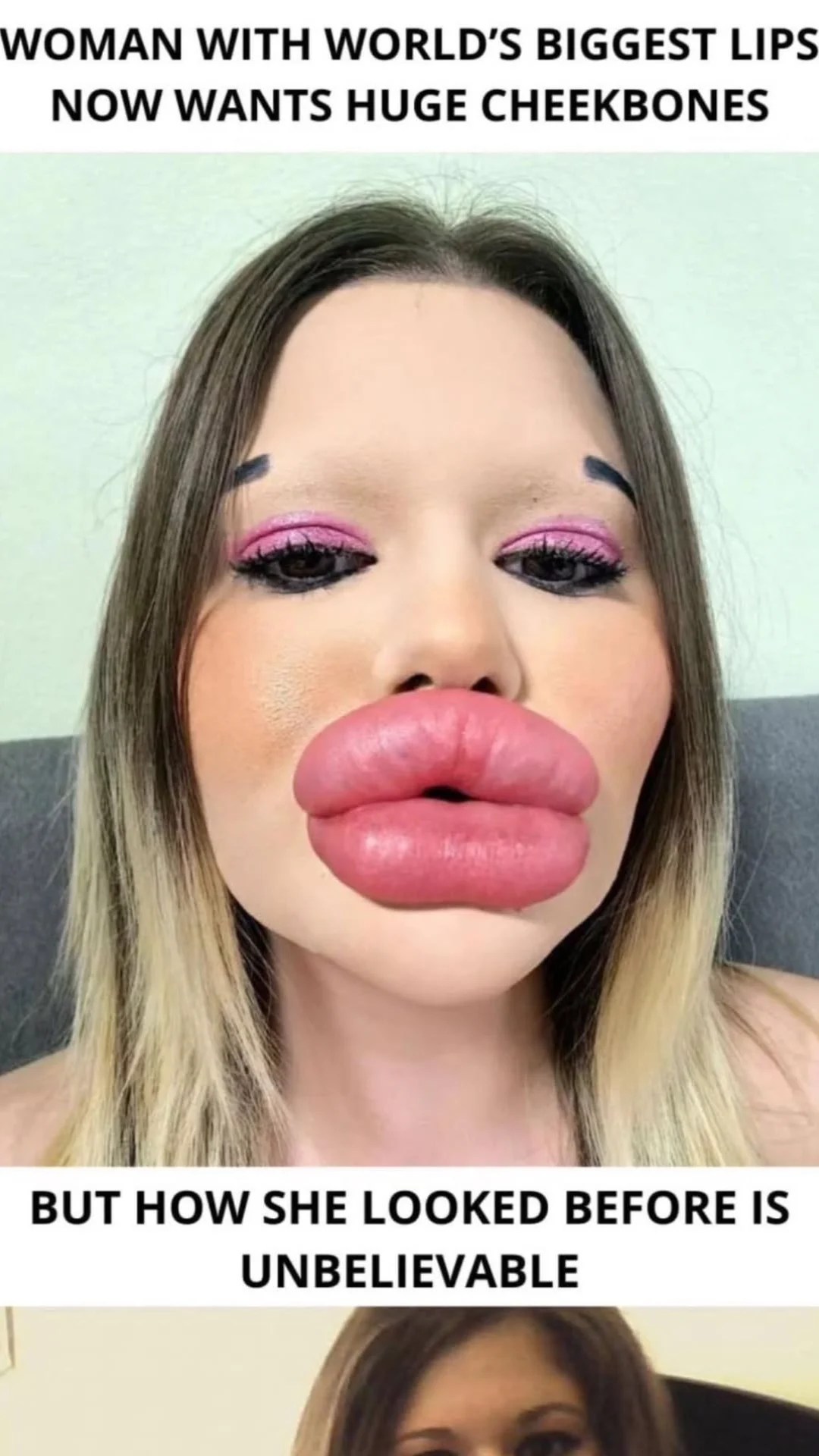 the-individual-boasting-the-largest-lips-on-the-planet-story
