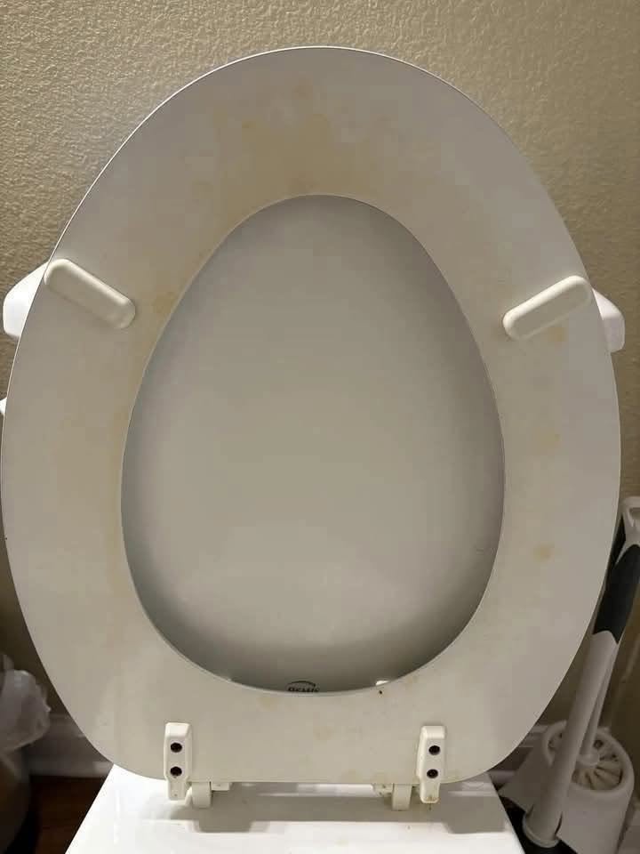 That Yellow Toilet Ring? Here’s How to Remove Common Bathroom Stains